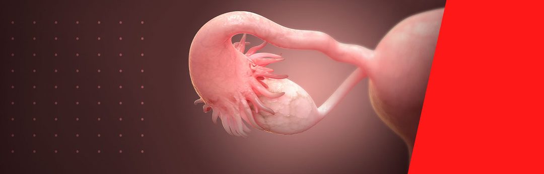 Endometriose: A Osteopatia contra todas as possibilidades clínicas – Um estudo de caso