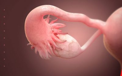 Endometriose: A Osteopatia contra todas as possibilidades clínicas – Um estudo de caso