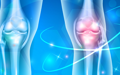 Tratamento Osteopático na dor de joelho crônica